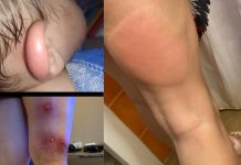 Vecinos de Butarque y Perales del Río exigen a las Administraciones públicas coordinación e implicación para mitigar el aumento de mosca negra